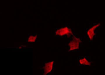 Polyclonal Rabbit anti-Human MECOM / EVI1 Antibody (IF, WB)
