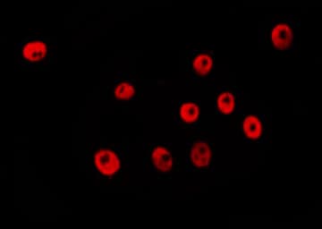 Polyclonal Rabbit anti-Human RNF20 Antibody (IF, WB)