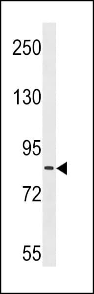 ZC3H11A Antibody (aa38-65)