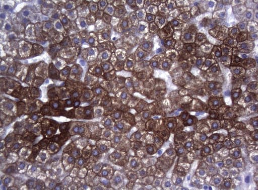 SYNC / SYNCOILIN Antibody (clone OTI5B8)