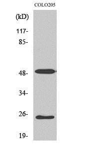 IHC-plus™ Polyclonal Rabbit anti-Human LRAT Antibody (aa111-160, IHC, IF, WB)