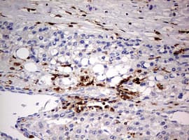 Monoclonal Mouse anti-Human DOCK2 Antibody (clone OTI7G2, aa1544-1830, IHC, WB)