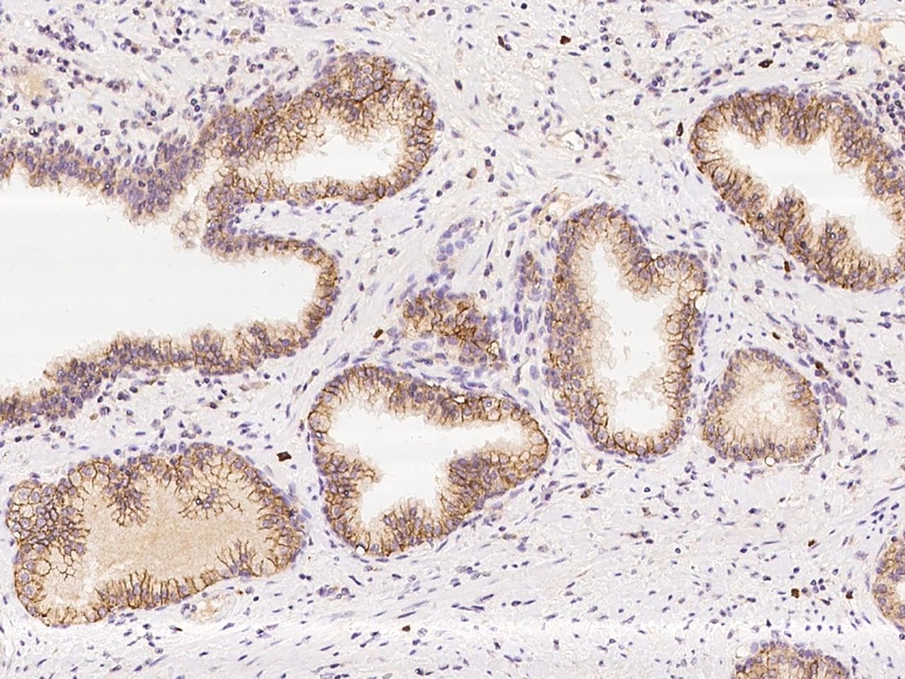 Polyclonal Rabbit anti-Human LETMD1 / HCCR1 Antibody (IHC)