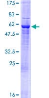 Human GTF2H3 Protein (Recombinant GST)