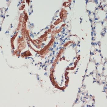 LRRK2 Antibody