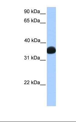 Polyclonal Rabbit anti-Human LDHB / Lactate Dehydrogenase B Antibody (C-Terminus, IHC, WB)