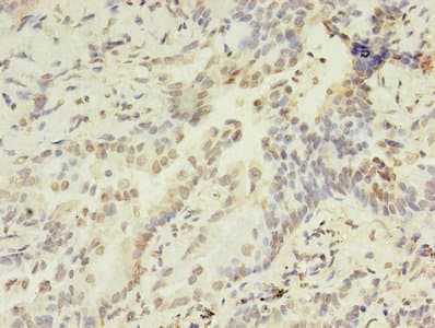 HIST1H2AG Antibody