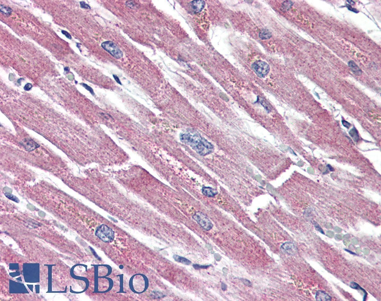 IHC-plus™ SSTR5 Antibody (Extracellular Domain)