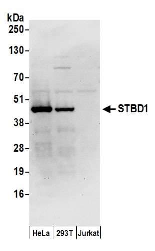 Polyclonal Rabbit anti-Human STBD1 Antibody (aa75-125, WB)