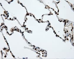 Monoclonal Mouse anti-Human APP / Beta Amyloid Precursor Antibody (clone OTI9E2, IHC, IF, WB)