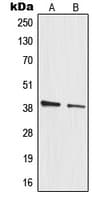 MRPL3 Antibody (Internal)