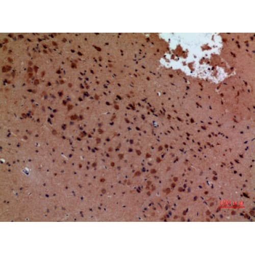 Polyclonal Rabbit anti-Human ABL2 Antibody (591-640 aa, Internal, IHC, WB)