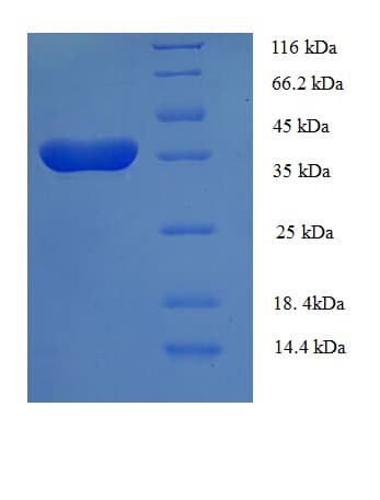 Human BAFF / TNFSF13B Protein (Recombinant His-SUMO)