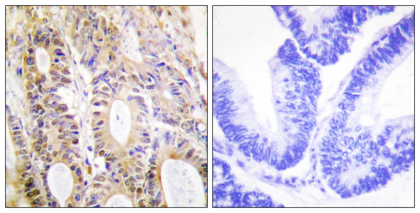 Polyclonal Rabbit anti-Human SMAD3 Antibody (p204, IHC, WB)