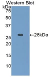 IGFBP4 Antibody (aa22-258, Cy3)