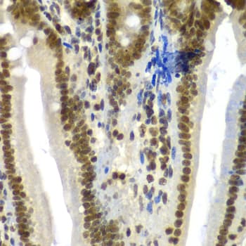 Polyclonal Rabbit anti-Human SF3B2 Antibody (IHC, IF, WB)