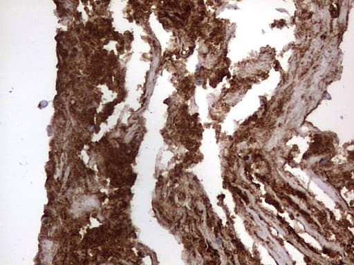 Monoclonal Mouse anti-Human CD63 Antibody (clone OTI5E5, IHC, WB)