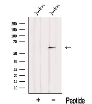 IRF2BP2 Antibody