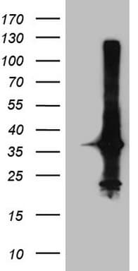 CRP / C-Reactive Protein Antibody (clone OTI7C3)