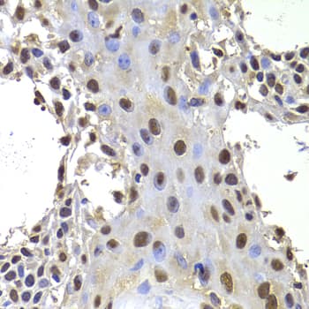 PRDM14 Antibody