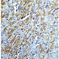 BIRC5 / Survivin Antibody