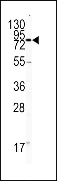 Polyclonal Rabbit anti-Human PECAM-1 / CD31 Antibody (aa690-718, IHC, WB)