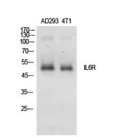 IL6R / IL6 Receptor Antibody (aa221-270)