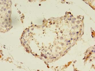 PANK1 / PANK Antibody