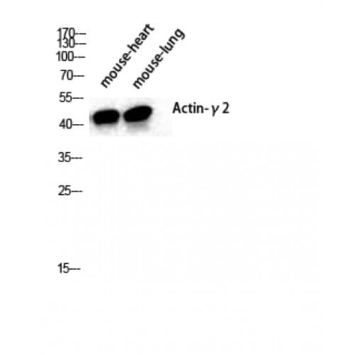 ACTG2 Antibody (1-80 aa, N-terminal)