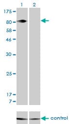 ITGB5 / Integrin Beta 5 Antibody (clone 2C4)