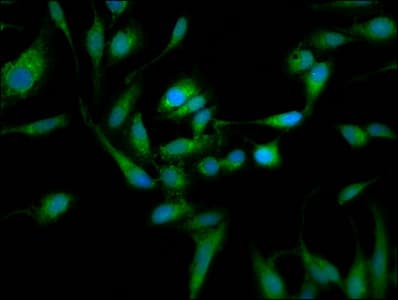 Polyclonal Rabbit anti-Human TOM1L1 Antibody (IHC, IF)