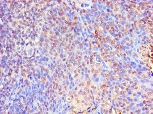 SMAD9 Antibody (aa1-300)