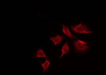 Polyclonal Rabbit anti-Human TK1 / TK / Thymidine Kinase Antibody (phospho-Ser13, IHC, IF, WB)