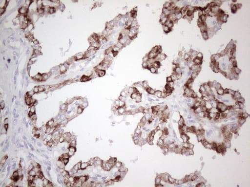 Monoclonal Mouse anti-Human KRT19 / CK19 / Cytokeratin 19 Antibody (clone UMAB188, Carrier-free, aa240-390, IHC, IF, WB)