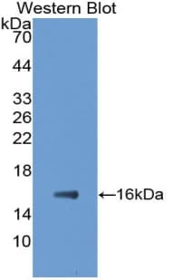 E-FABP / FABP5 Antibody (aa2-135)