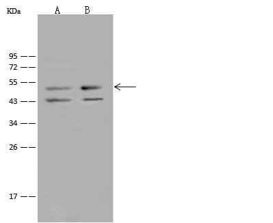 GABRD Antibody