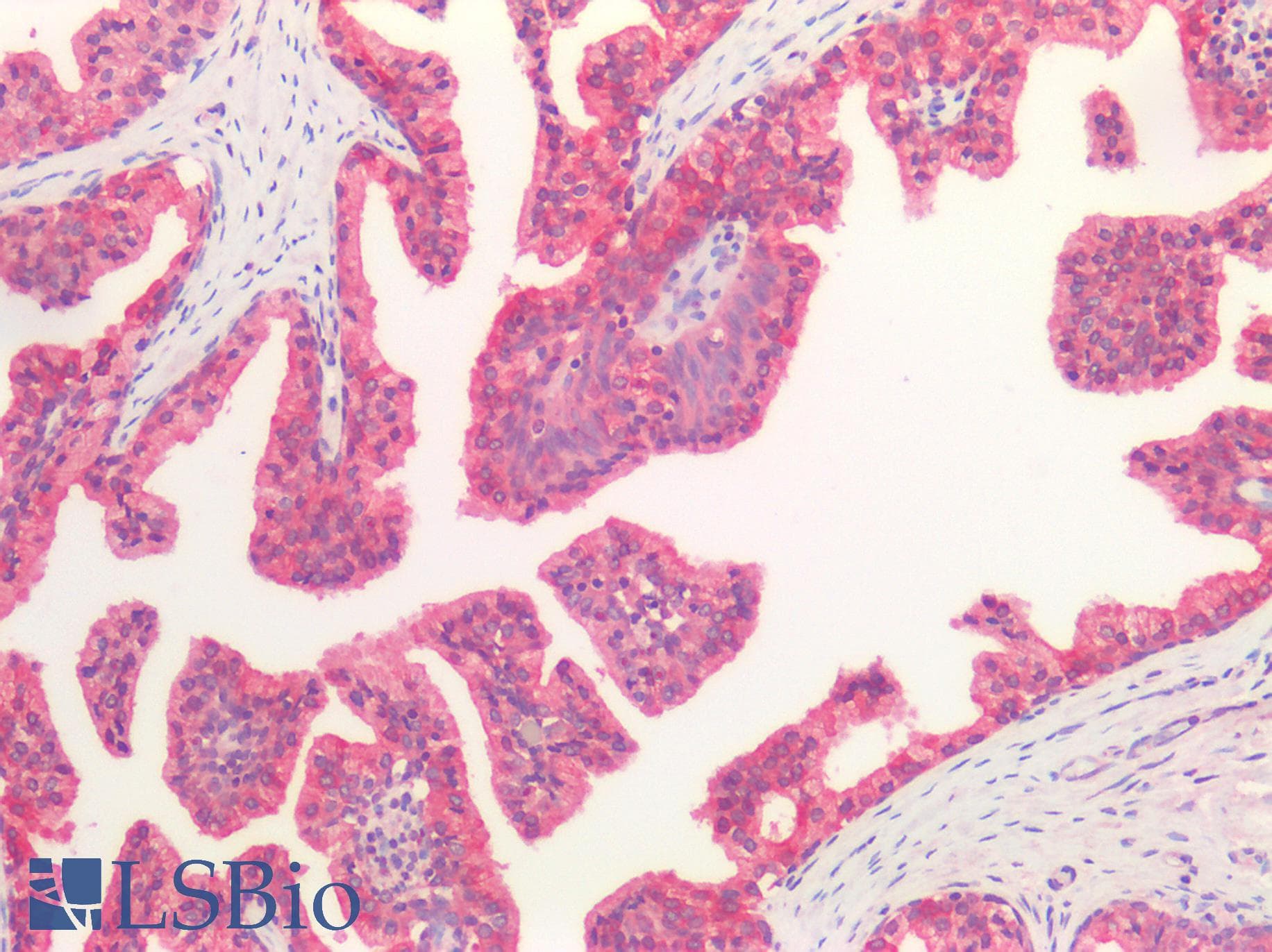 IHC-plus™ HGF / Hepatocyte Growth Factor Antibody