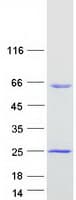 Human AAMP Protein (Recombinant Myc-DDK (Flag))
