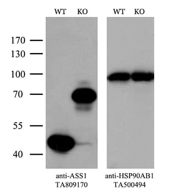 ASS1 / ASS Antibody (C-Terminus, clone OTI8H4)