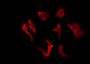 Polyclonal Rabbit anti-Human OR2B2 Antibody (IF, WB)