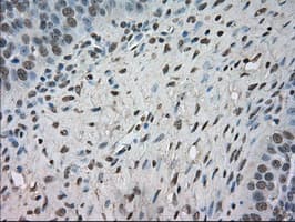 NTRK3 / TRKC Antibody (clone OTI24B3)