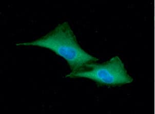 GSTP1 / GST Pi Antibody (clone AT12C10)