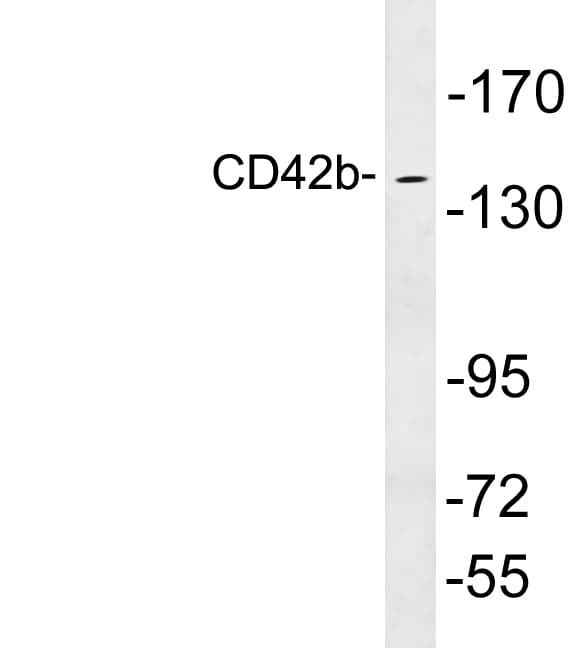 GP1BA / CD42b Antibody (aa563-612)