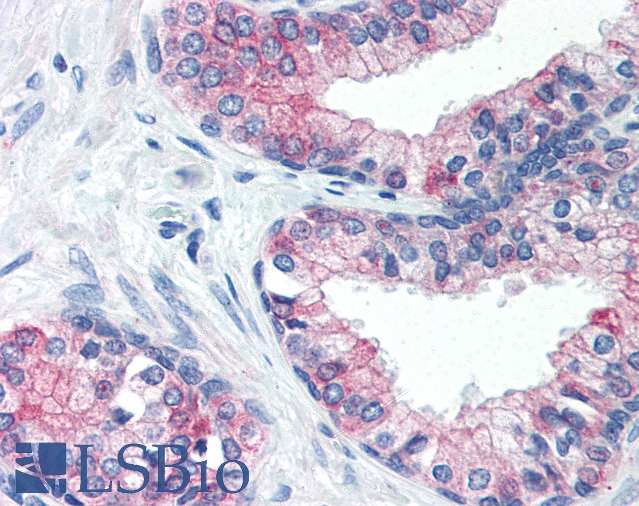 IHC-plus™ ATF3 Antibody