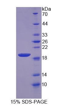Human NUDC Protein (Recombinant His-S)