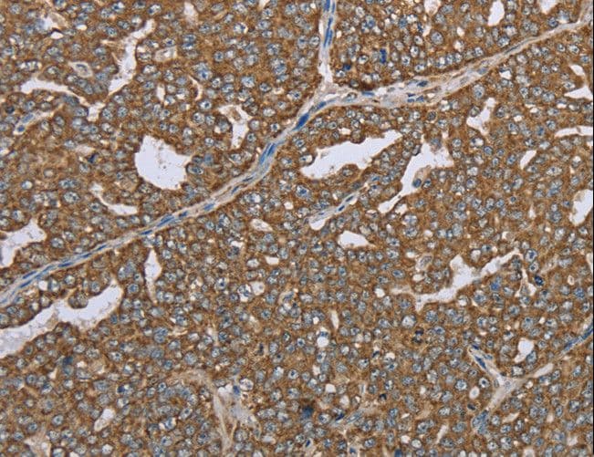 LASS4 Antibody