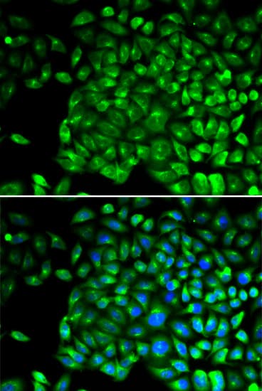 Polyclonal Rabbit anti-Human TNFRSF1B / TNFR2 Antibody (IHC, IF, WB)