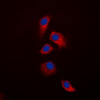 OPG / Osteoprotegerin Antibody (N-Terminus)