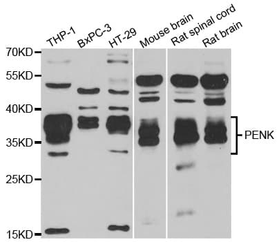 PathPlus™ Proenkephalin / PENK Antibody (aa 25-267)