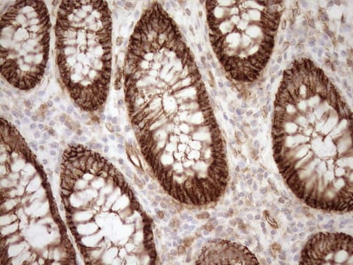 Monoclonal Mouse anti-Human EPLIN Antibody (clone OTI7H5, Carrier-free, aa1-275, IHC, WB)